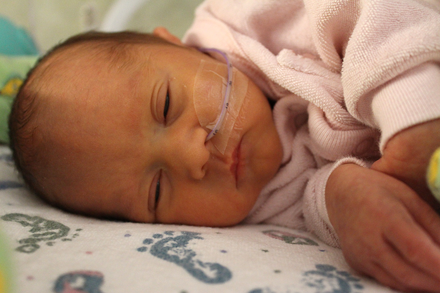 NICU baby with feeding tube in nose